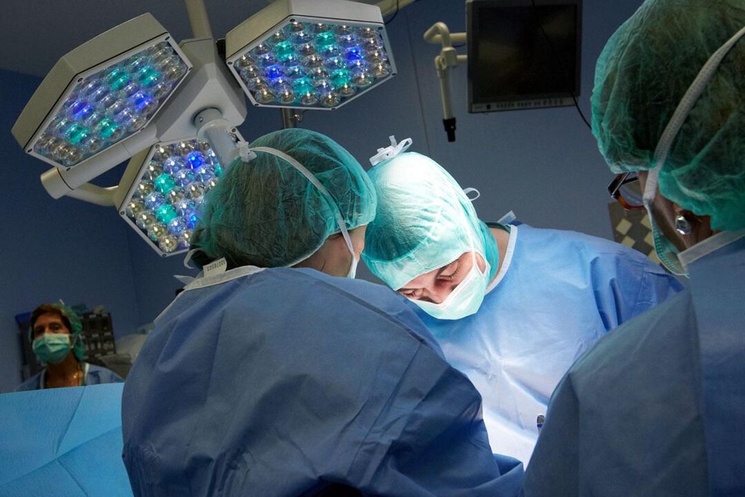 Chronic prostatitis surgery
