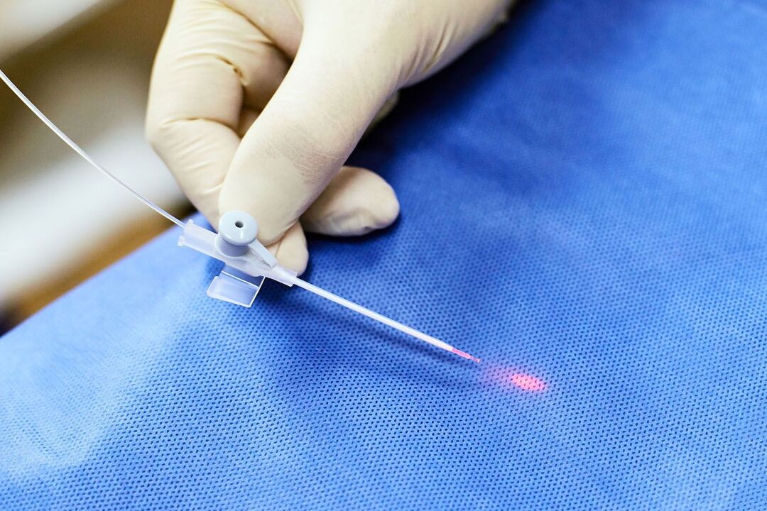 transrectal device for the treatment of the prostate